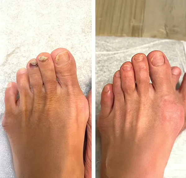 Before and After